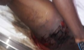 Au Gabon, la torture encore et toujours. 